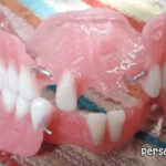 لابراتوار دندانسازی پروتزهای متحرک اُسکار